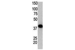 Western Blotting (WB) image for anti-Small Ubiquitin Related Modifier 2 (SUMO2) (AA 63-93) antibody (ABIN3032648)