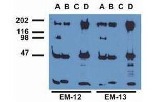 Western Blotting (WB) image for anti-Epidermal Growth Factor Receptor (EGFR) (pTyr1197) antibody (ABIN400879) (EGFR 抗体  (pTyr1197))