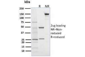 SDS-PAGE Analysis Purified Desmoglein-1 Mouse Monoclonal Antibody (32-2B). (Desmoglein 1 抗体)