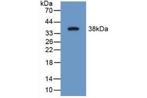 Detection of Recombinant SYN1, Mouse using Polyclonal Antibody to Synapsin I (SYN1) (SYN1 抗体  (AA 113-420))