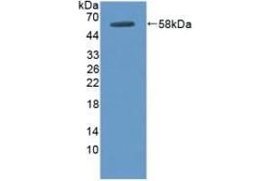Detection of Recombinant DOK3, Human using Polyclonal Antibody to Docking Protein 3 (DOK3) (DOK3 抗体  (AA 128-385))