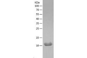 Interleukin 8 (IL8) (AA 28-99) (Active) protein (His tag)