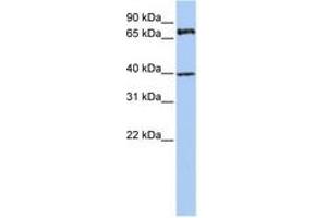Image no. 1 for anti-Membrane Protein, Palmitoylated 5 (MAGUK P55 Subfamily Member 5) (MPP5) (AA 36-85) antibody (ABIN6740785)