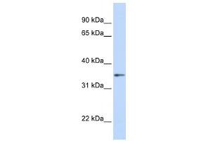 GNB1 antibody used at 1 ug/ml to detect target protein. (GNB1 抗体)