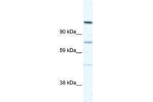 WB Suggested Anti-D930005D10RIK Antibody Titration:  5. (Radil 抗体  (C-Term))