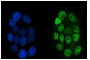 IF analysis of p95 NBS1 using anti-p95 NBS1 antibody (ABIN7602793). (Nibrin 抗体  (C-Term))