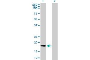 Western Blot analysis of C9orf89 expression in transfected 293T cell line by C9orf89 MaxPab polyclonal antibody. (C9orf89 抗体  (AA 1-183))