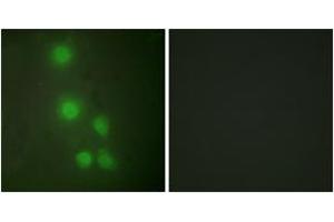 Immunofluorescence analysis of HuvEc cells, using ACTL6A Antibody. (BAF53A 抗体  (AA 201-250))