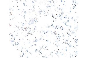 anti-Achaete-Scute Complex Homolog 1 (Drosophila) (ASCL1) (AA 186-236) antibody