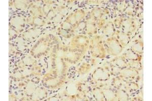 Immunohistochemistry of paraffin-embedded human pancreatic tissue using ABIN7175970 at dilution of 1:100 (ZNF238 抗体  (AA 62-364))