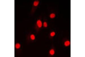 Immunofluorescent analysis of DNA Ligase 4 staining in HepG2 cells. (LIG4 抗体  (Center))