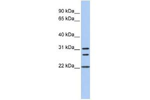 WB Suggested Anti-CNN1 Antibody Titration:  0. (CNN1 抗体  (N-Term))