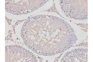 Immunohistochemistry (IHC) image for anti-Proteasome (Prosome, Macropain) 26S Subunit, ATPase, 4 (PSMC4) antibody (ABIN1874384) (PSMC4 抗体)