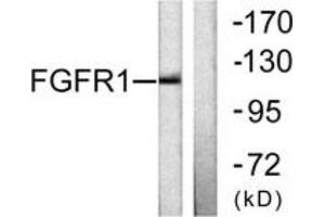 Western blot analysis of extracts from 293 cells, using FGFR1 (Ab-654) Antibody. (FGFR1 抗体  (AA 626-675))