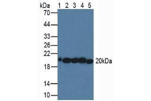 Western blot analysis of (1) Human Serum, (2) Porcine Liver Tissue, (3) Human HeLa cells, (4) Porcine Brain Tissue and (5) Human MCF-7 Cells. (SOD2 抗体  (AA 25-222))