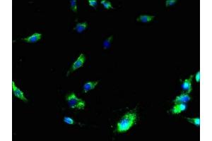 Immunofluorescent analysis of U251 cells using ABIN7159383 at dilution of 1:100 and Alexa Fluor 488-congugated AffiniPure Goat Anti-Rabbit IgG(H+L) (MS4A3 抗体  (AA 1-49))