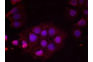 Immunofluorescence staining of methanol-fixed MCF cells using Estrogen Receptor-a(Phospho-Ser118) Antibody. (Estrogen Receptor alpha 抗体  (pSer118))
