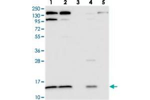 Western blot analysis of Lane 1: RT-4, Lane 2: U-251 MG, Lane 3: Human Plasma, Lane 4: Liver, Lane 5: Tonsil with CMC1 polyclonal antibody . (CMC1 抗体)