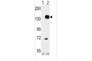 Western blot analysis of TEK using rabbit polyclonal TEK Antibody using 293 cell lysates (2 ug/lane) either nontransfected (Lane 1) or transiently transfected with the TEK gene (Lane 2). (TEK 抗体  (C-Term))