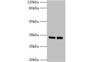 Western blot All lanes: SRM antibody at 2 μg/mL Lane 1: EC109 whole cell lysate Lane 2: 293T whole cell lysate Secondary Goat polyclonal to rabbit IgG at 1/15000 dilution Predicted band size: 34 kDa Observed band size: 34 kDa (Spermidine Synthase 抗体  (AA 17-302))