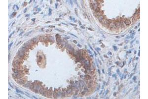 Immunohistochemical staining of formalin-fixed paraffin-embedded human fetal kidney tissue showing cytoplasmic staining with ECH1 polyclonal antibody  at 1 : 100 dilution. (ECH1 抗体  (AA 145-325))