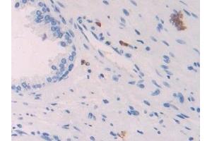 Immunohistochemistry (IHC) image for anti-Platelet Factor 4 (PF4) (AA 31-101) antibody (ABIN7431254)