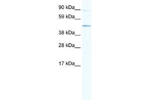 WB Suggested Anti-SITPEC Antibody Titration:  1. (ECSIT 抗体  (Middle Region))