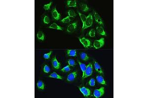 Immunofluorescence analysis of U2OS cells using LARS Rabbit pAb (ABIN7268238) at dilution of 1:100. (LARS 抗体  (AA 1-270))