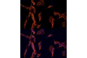 Immunofluorescence (IF) image for anti-Epidermal Growth Factor Receptor Pathway Substrate 15 (EPS15) (AA 660-840) antibody (ABIN6140236)