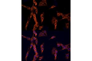 Immunofluorescence analysis of C6 cells using EPS15 Rabbit pAb  at dilution of 1:200 (40x lens). (EPS15 抗体  (AA 660-840))