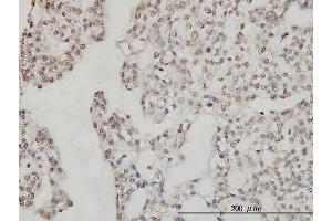 Immunostaining (ISt) image for anti-DEAD (Asp-Glu-Ala-Asp) Box Polypeptide 54 (DDX54) (AA 778-881) antibody (ABIN566333)