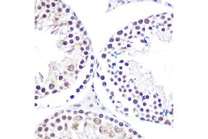 Immunohistochemistry of paraffin-embedded mouse testis using NELFE Rabbit pAb (ABIN6127278, ABIN6144526, ABIN6144528 and ABIN6220173) at dilution of 1:100 (40x lens). (RDBP 抗体  (AA 1-280))
