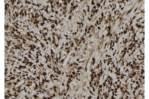 ABIN6277748 at 1/100 staining Human gastric tissue by IHC-P.