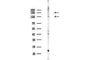 Western blot analysis of lysates from COLO205 cells(UV,30 min treatment), using Integrin alpha 5 Antibody at 1/1000 dilution.