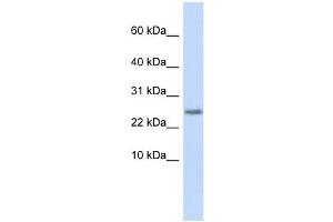 Cystatin 9 antibody used at 1 ug/ml to detect target protein. (CST9 抗体)