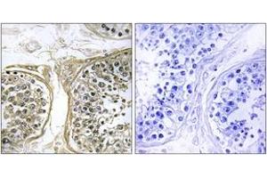 Immunohistochemistry analysis of paraffin-embedded human testis, using Cytochrome P450 2C8 Antibody.