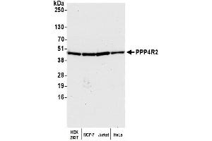 Western Blotting (WB) image for anti-Protein Phosphatase 4, Regulatory Subunit 2 (PPP4R2) (C-Term) antibody (ABIN7453641) (PPP4R2 抗体  (C-Term))