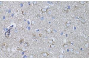 Immunohistochemistry of paraffin-embedded Rat brain using MYH10 Polyclonal Antibody at dilution of 1:100 (40x lens). (MYH10 抗体)