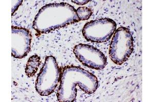 Immunohistochemistry (IHC) image for anti-Arginase, Type II (ARG2) (N-Term) antibody (ABIN3030019)