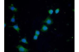 Immunohistochemistry (IHC) image for anti-Ferritin, Heavy Polypeptide 1 (FTH1) (AA 1-183) antibody (ABIN7435313)