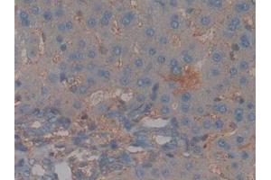Detection of CFH in Rat Liver Tissue using Polyclonal Antibody to Complement Factor H (CFH) (Complement Factor H 抗体  (AA 975-1217))