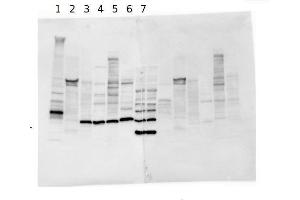 Western Blotting (WB) image for anti-Desmoplakin (DSP) antibody (ABIN1742177)