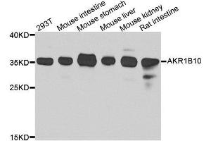 Western blot analysis of extracts of various cell lines, using AKR1B10 antibody. (AKR1B10 抗体  (AA 1-316))