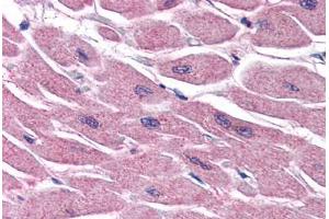 Human Heart (formalin-fixed, paraffin-embedded) stained with STRADB antibody ABIN351469 at 3. (STRADB 抗体  (AA 406-418))