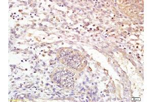 Immunohistochemistry (Paraffin-embedded Sections) (IHC (p)) image for anti-Leukotriene B4 Receptor (LTB4R) (AA 101-200) antibody (ABIN748628)