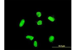 Immunofluorescence of purified MaxPab rabbit antibody to ACTN4 on HeLa cell. (alpha Actinin 4 抗体  (AA 1-911))