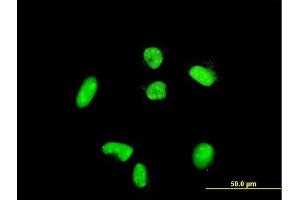 Immunofluorescence of purified MaxPab rabbit antibody to ACTN4 on HeLa cell.