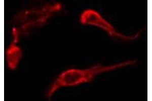 ABIN6274208 staining HepG2 cells by IF/ICC. (AKAP5 抗体  (N-Term))