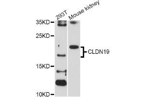 Western blot analysis of extracts of various cell lines, using CLDN19 Antibody (ABIN1871893) at 1:1000 dilution. (Claudin 19 抗体)