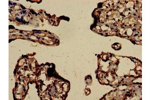 Immunohistochemistry of paraffin-embedded human placenta tissue using ABIN7172843 at dilution of 1:100 (RHOA 抗体  (AA 1-191))
